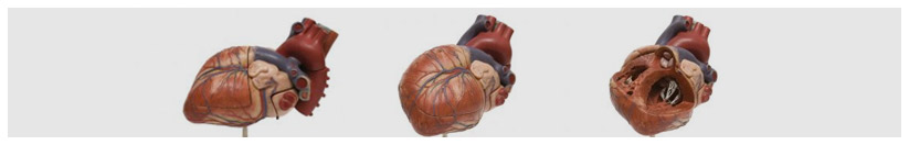 Nuclear Cardiology FAQs